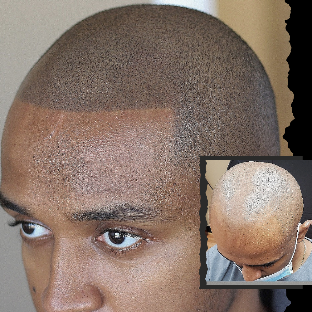 copy of before and after (4)